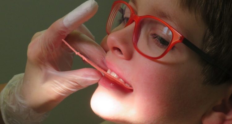 child teeth